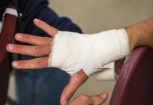 Innovations in Healing: Exploring Alternative Therapies for Personal Injury Rehabilitation person in white gloves holding persons hand