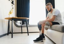 What Compensation You Can Seek for Amputation Injuries